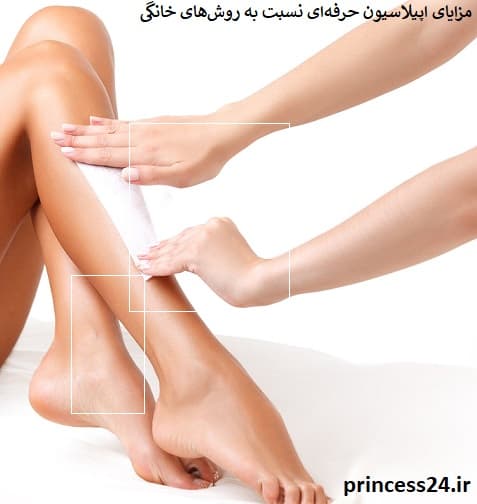 مزایای اپیلاسیون حرفه‌ای نسبت به روش‌های خانگی