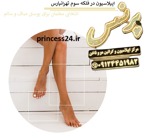 اپیلاسیون در فلکه سوم تهرانپارس؛ انتخابی مطمئن برای پوستی صاف و سالم