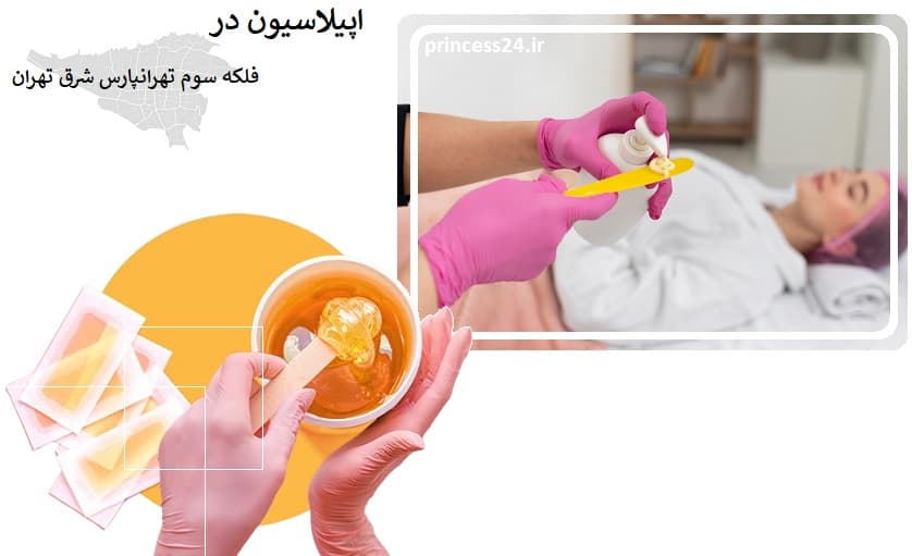 اپیلاسیون در فلکه سوم تهرانپارس شرق تهران