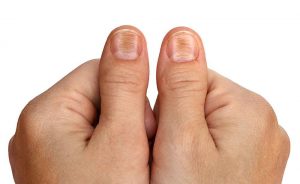 ترمیم ناخن ها