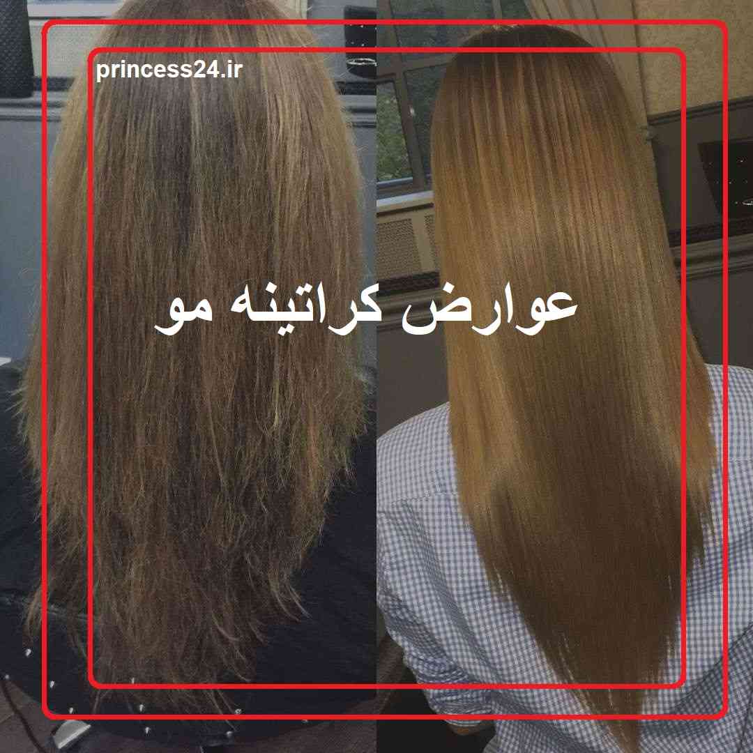 عوارض کراتینه مو