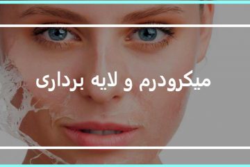 میکرودرم و لایه برداری در آرایشگاه تهرانپارس
