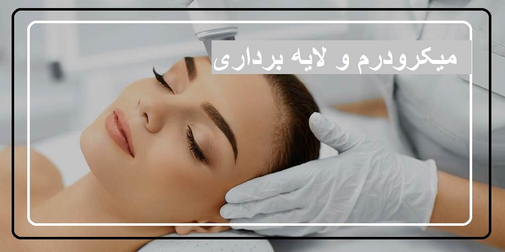 میکرودرم و لایه برداری
