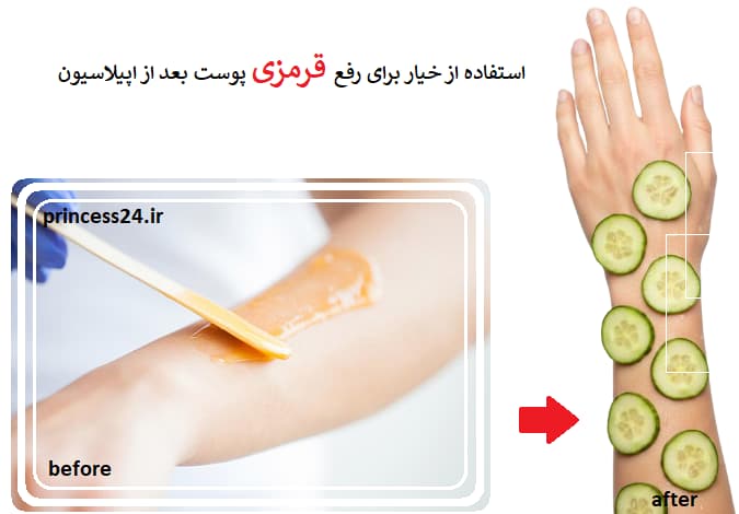 استفاده از خیار برای رفع قرمزی پوست بعد از اپیلاسیون